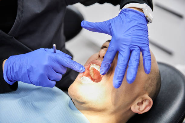 Best Urgent Care for Lost Fillings or Crowns in Blackwater, AZ